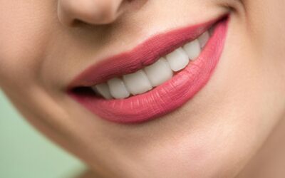 Preventing Gum Disease During Menopause:  Proactive Tips for Maintaining Oral Health