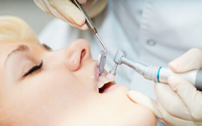 National Dental Hygiene Month: Protect Your Gums with Professional Cleaning in London