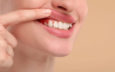 Periodontal Maintenance: How Often Should You See a Gum Specialist?