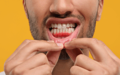The Hidden Link Between Gum Disease and Heart Disease