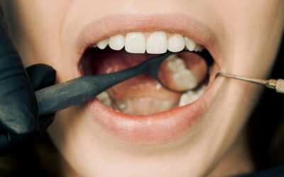 The Bacteria You’re Missing: What Lives in Your Gum Pockets and Why It Matters